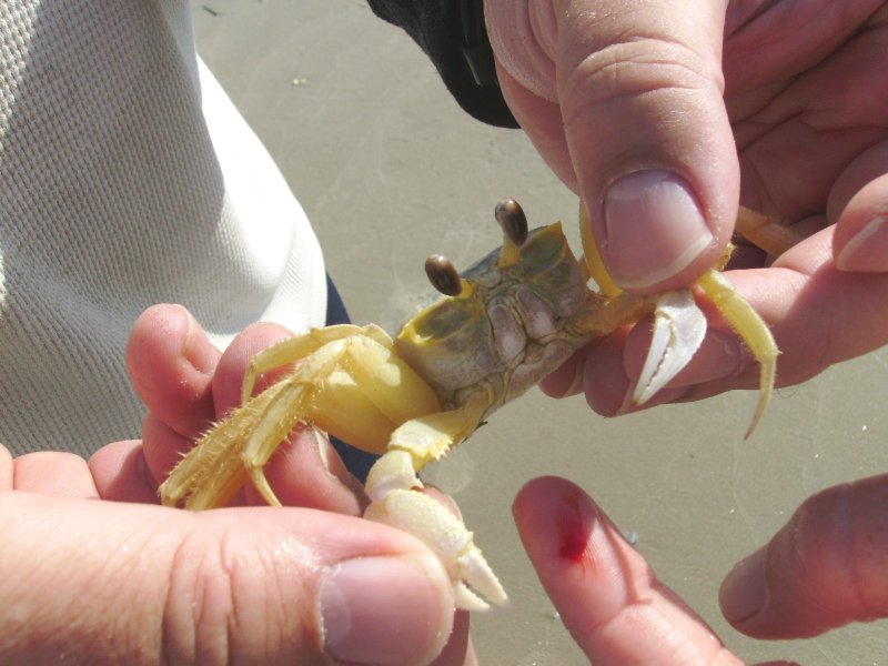 crab bite on finger